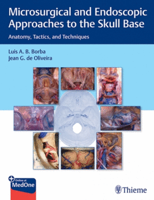 MICROSURGICAL AND ENDOSCOPIC APPROACHES TO THE SKULL BASE. ANATOMY, TACTICS, AND TECHNIQUES