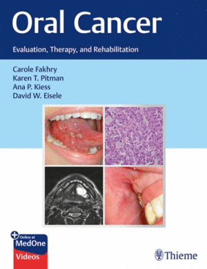 ORAL CANCER. EVALUATION, THERAPY, AND REHABILITATION