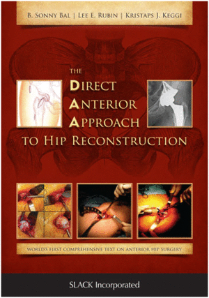DIRECT ANTERIOR APPROACH TO HIP RECONSTRUCTION