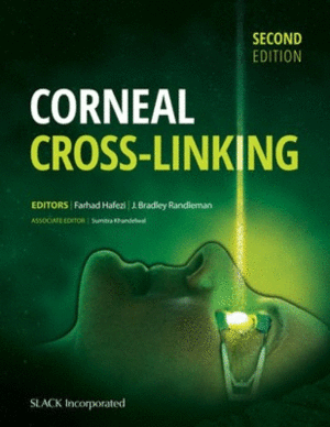 CORNEAL CROSS-LINKING. 2ND EDITION