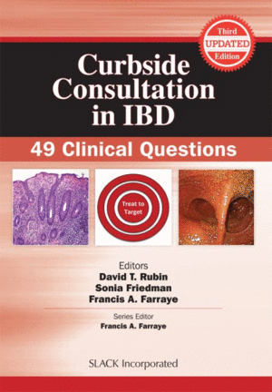 CURBSIDE CONSULTATION IN IBD. 49 CLINICAL QUESTIONS. 3RD EDITION