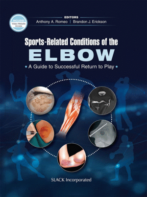 SPORTS-RELATED CONDITONS OF THE ELBOW. A GUIDE TO SUCCESSFUL RETURN TO PLAY