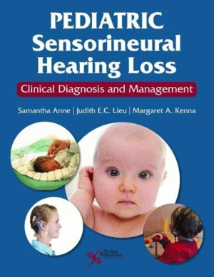 PEDIATRIC SENSORINEURAL HEARING LOSS. CLINICAL DIAGNOSIS AND MANAGEMENT