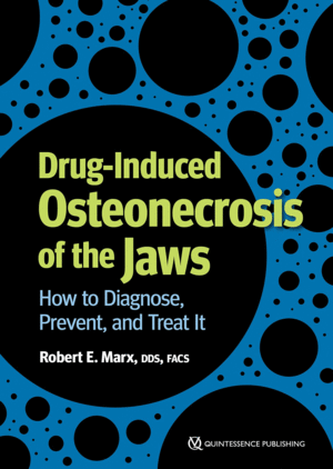 DRUG-INDUCED OSTEONECROSIS OF THE JAWS. HOW TO DIAGNOSE, PREVENT, AND TREAT IT