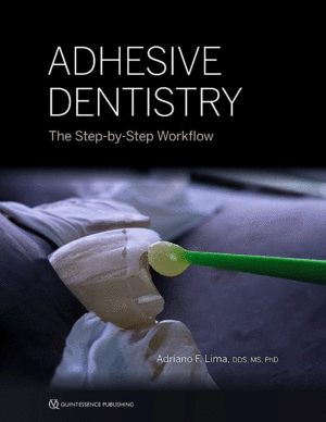 ADHESIVE DENTISTRY. THE STEP-BY-STEP WORKFLOW