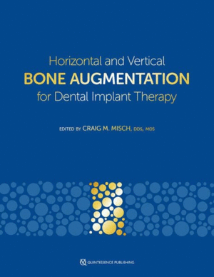 HORIZONTAL AND VERTICAL BONE AUGMENTATION FOR DENTAL IMPLANT THERAPY