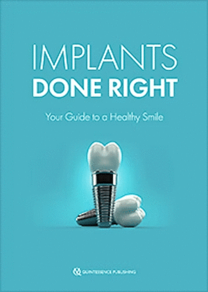 IMPLANTS DONE RIGHT. YOUR GUIDE TO A HEALTHY SMILE