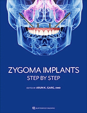 ZYGOMA IMPLANTS. STEP BY STEP