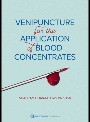 VENIPUNCTURE FOR THE APPLICATION OF BLOOD CONCENTRATES