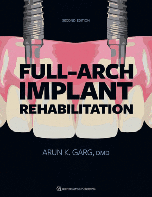 FULL-ARCH IMPLANT REHABILITATION. 2ND EDITION
