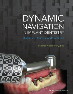 DYNAMIC NAVIGATION IN IMPLANT DENTISTRY. DIAGNOSIS, PLANNING, AND EXECUTION
