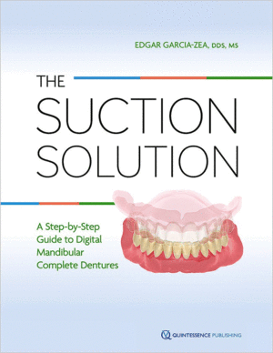 THE SUCTION SOLUTION. A STEP-BY-STEP GUIDE TO DIGITAL MANDIBULAR COMPLETE DENTURES