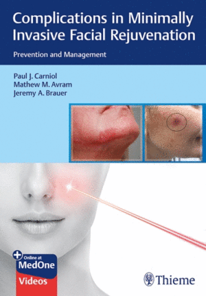 COMPLICATIONS IN MINIMALLY INVASIVE FACIAL REJUVENATION. PREVENTION AND MANAGEMENT