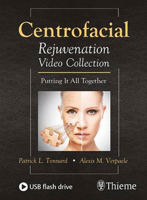 CENTROFACIAL REJUVENATION VIDEO COLLECTION. PUTTING IT ALL TOGETHER. USB FLASH DRIVE