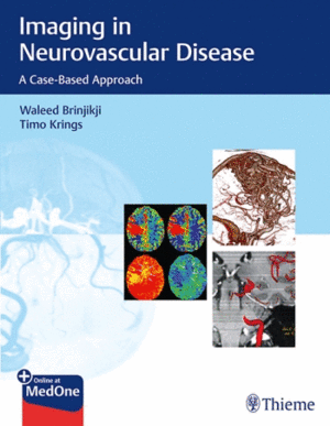 IMAGING IN NEUROVASCULAR DISEASE. A CASE-BASED APPROACH + ONLINE AT MEDONE