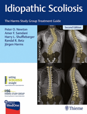 IDIOPATHIC SCOLIOSIS. THE HARMS STUDY GROUP TREATMENT GUIDE. 2ND EDITION