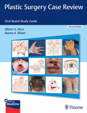 PLASTIC SURGERY CASE REVIEW. ORAL BOARD STUDY GUIDE. 2ND EDITION