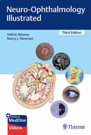 NEURO-OPHTHALMOLOGY ILLUSTRATED + ONLINE AT MEDONE. 3RD EDITION