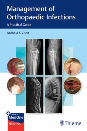 MANAGEMENT OF ORTHOPAEDIC INFECTIONS. A PRACTICAL GUIDE