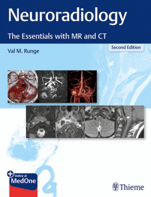 NEURORADIOLOGY. THE ESSENTIALS WITH MR AND CT. 2ND EDITION