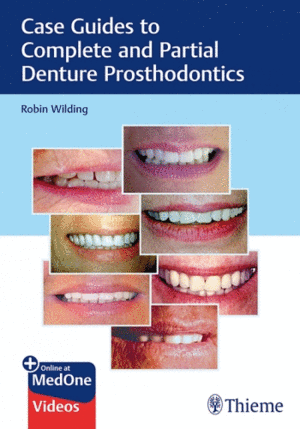 CASE GUIDES TO COMPLETE AND PARTIAL DENTURE PROSTHODONTICS