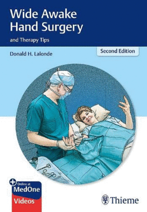 WIDE AWAKE HAND SURGERY AND THERAPY TIPS. 2ND EDITION