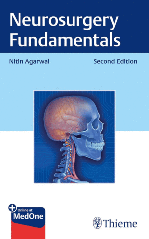 NEUROSURGERY FUNDAMENTALS. 2ND EDITION