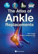 THE ATLAS OF ANKLE REPLACEMENTS. (HARDCOVER)