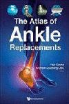 THE ATLAS OF ANKLE REPLACEMENTS. (SOFTCOVER)