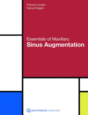 ESSENTIALS OF MAXILLARY SINUS AUGMENTATION