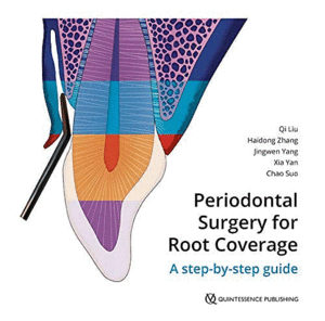 PERIODONTAL SURGERY FOR ROOT COVERAGE. A STEP-BY-STEP GUIDE