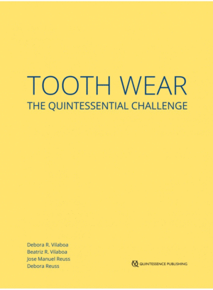 TOOTH WEAR THE QUINTESSENTIAL CHALLENGE