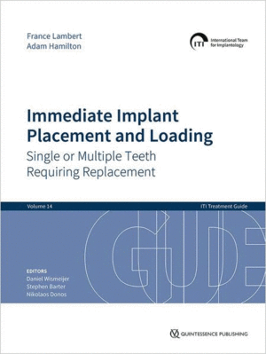 IMMEDIATE IMPLANT PLACEMENT AND LOADING. SINGLE OR MULTIPLE TEETH REQUIRING REPLACEMENT