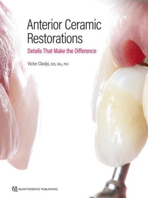 ANTERIOR CERAMIC RESTORATIONS. DETAILS THAT MAKE THE DIFFERENCE