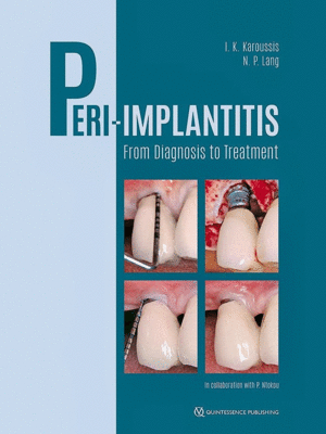 PERI-IMPLANTITIS. FROM DIAGNOSIS TO TREATMENT