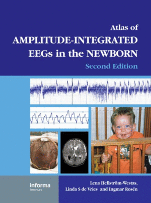 AN ATLAS OF AMPLITUDE-INTEGRATED EEGS IN THE NEWBORN, 2ND EDITION