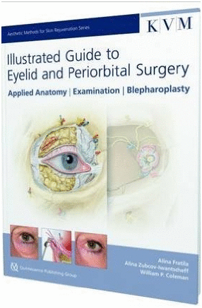 ILLUSTRATED GUIDE TO EYELID AND PERIORBITAL SURGERY