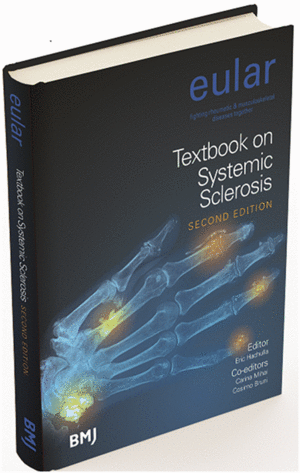 EULAR TEXTBOOK ON SYSTEMIC SCLEROSIS. 2ND EDITION