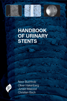 HANDBOOK OF URINARY STENTS