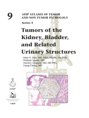 TUMORS OF THE KIDNEY, BLADDER, AND RELATED URINARY STRUCTURES (AFIP ATLASES OF TUMOR AND NON-TUMOR PATHOLOGY, SERIES 5, VOL. 9)