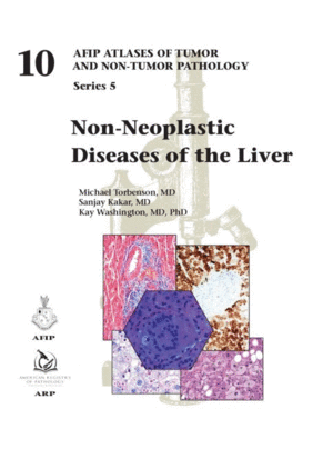 NON-NEOPLASTIC DISEASES OF THE LIVER. (AFIP ATLASES OF TUMOR AND NON-TUMOR PATHOLOGY, SERIES 5, VOL. 10)