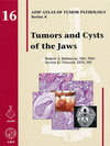 TUMORS AND CYSTS OF THE JAWS