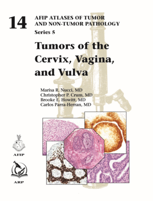 TUMORS OF THE CERVIX, VAGINA, AND VULVA (AFIP ATLAS OF TUMOR AND NON-TUMOR PATHOLOGY, SERIES 5, VOLUME 14)