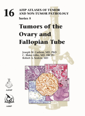 TUMORS OF THE OVARY AND FALLOPIAN TUBE (AFIP ATLAS OF TUMOR AND NON-TUMOR PATHOLOGY, SERIES 5, 16)