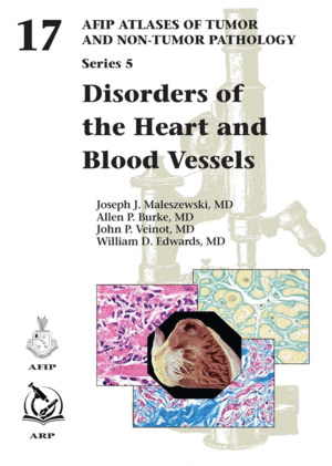 DISORDERS OF THE HEART AND BLOOD VESSELS (AFIP ATLAS OF TUMOR AND NON-TUMOR PATHOLOGY, SERIES 5, 17)