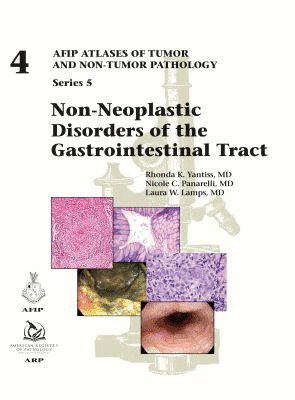 NON-NEOPLASTIC DISORDERS OF THE GASTROINTESTINAL TRACT (AFIP ATLASES OF TUMOR AND NON-TUMOR PATHOLOGY, SERIES 5, VOL. 4)