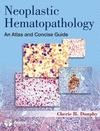 NEOPLASTIC HEMATOPATHOLOGY