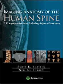 IMAGING ANATOMY OF THE HUMAN SPINE. A COMPREHENSIVE ATLAS INCLUDING ADJACENT STRUCTURES