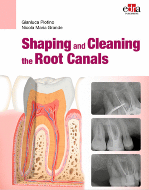 SHAPING AND CLEANING THE ROOT CANALS