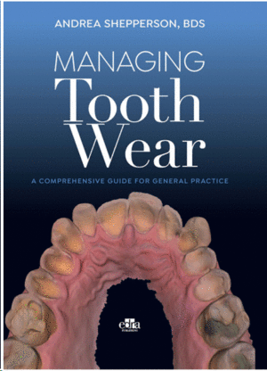 MANAGING TOOTH WEAR. A COMPREHENSIVE GUIDE TO GENERAL PRACTICE